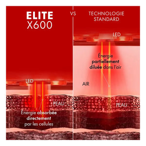 Nooance - Elite X600 LED Gesichtsmaske