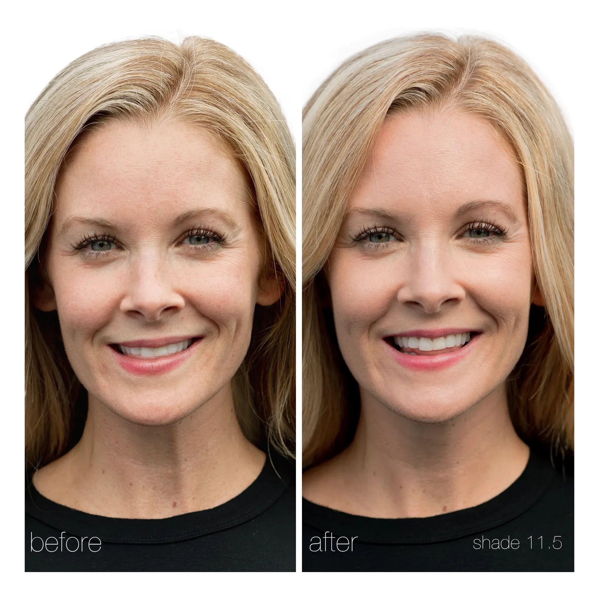 RMS Beauty - UnCoverup Concealer - 5,67 g | 11,5